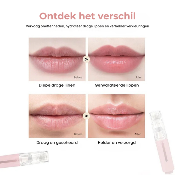 Lip Booster® Infusion Roller | Voor Gezonde, Vollere Lippen met Intense Hydratatie