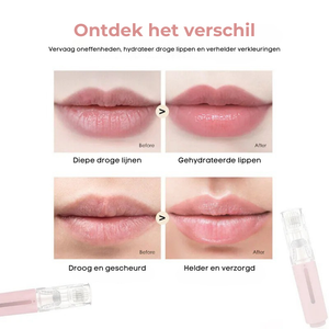 Lip Booster® Infusion Roller | Voor Gezonde, Vollere Lippen met Intense Hydratatie